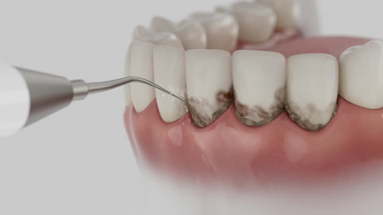 Reliable Dental Implants contractor in Saugatuck, CT by Smile Center Dentistry